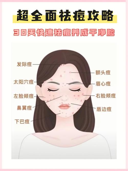 祛痘常见项目有哪些(祛痘项目皮肤痘痘效果)