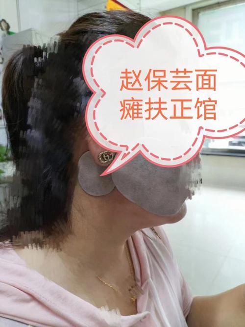 泉州面瘫多美模糊双眼女士(女士面瘫泉州店员产品)