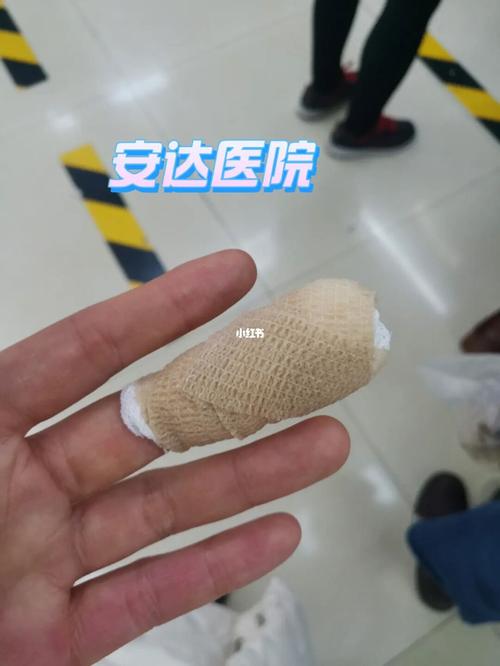 急诊北京这所医院项目(急诊创面患者伤口北京)
