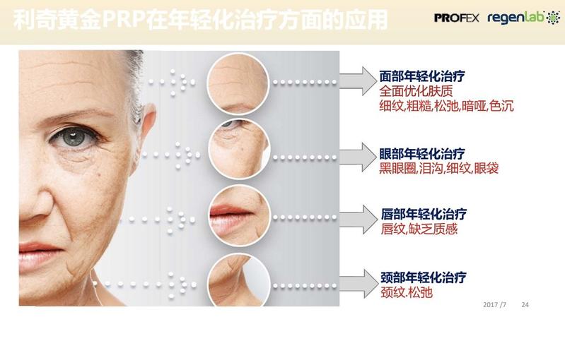 整形美容领域专栏PRP(血小板专栏领域整形美容组织)