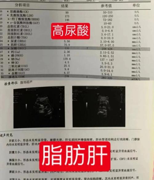 火爆项目(手术脂肪面部异物尿酸)