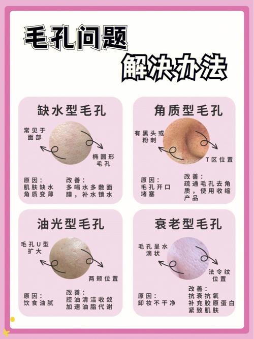 粗大毛孔十种方法(毛孔粗大肌肤村夫十种)