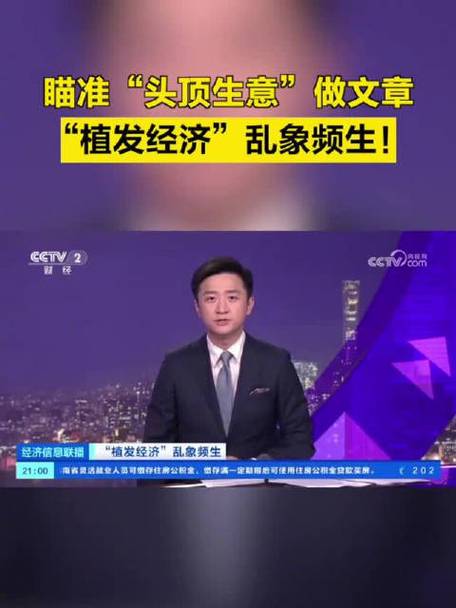无忧头顶公益活动今日植发(植发无忧小卡头顶公益活动)