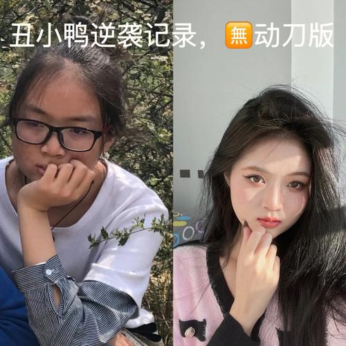 淮南丑小鸭祛斑(淮南皮肤丑小鸭是因为祛斑)