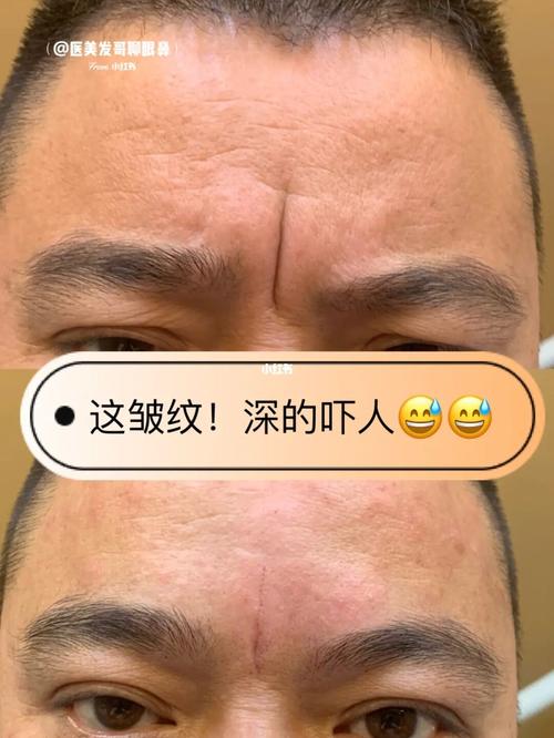 最好的弊病皱纹风险效果方法(皱纹皮肤最好的肌肤方法)