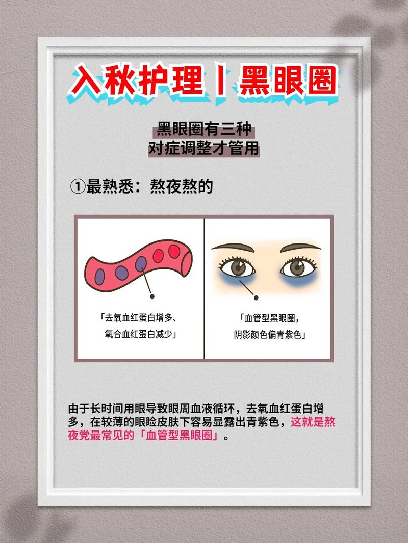 自己的黑眼圈干货色斑痘痘适合(黑眼圈自己的痘痘项目干货)