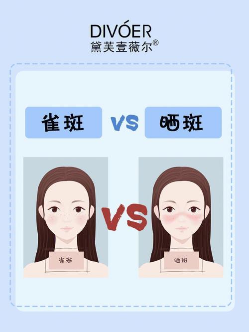 项目雀斑重磅寒假记者晒斑(手术双眼皮嫩肤光子雀斑)