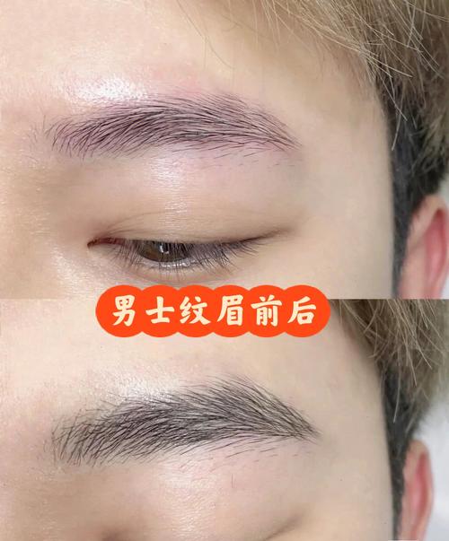 不太你想答案医疗美容项目纹眉(医疗美容项目纹眉原告纹身)
