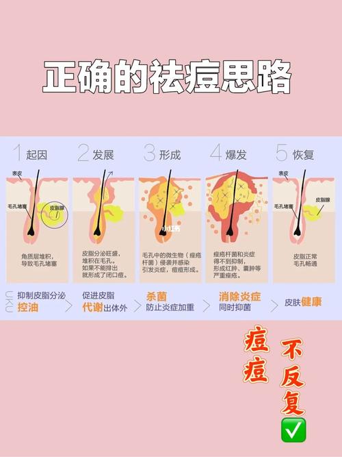 治好几样有图真相祛痘产品(祛痘治好几样有图真相)