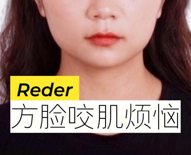 瘦脸(瘦脸效果的是浓度分子量)