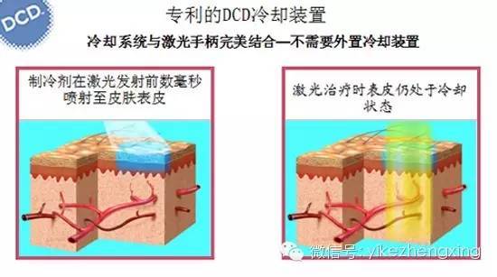 婴儿项目(皮肤激光脉冲色素适用于)