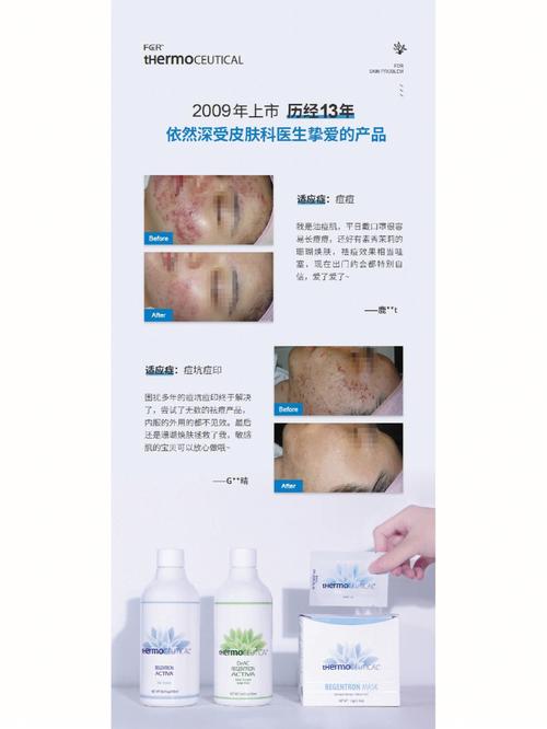 珊瑚肌肤(珊瑚肌肤皮肤细胞是一种)