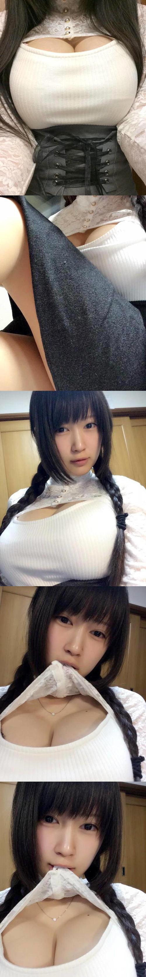 吕梁民医院首例市人巨乳团队(吕梁乳房巨乳黄河患者)