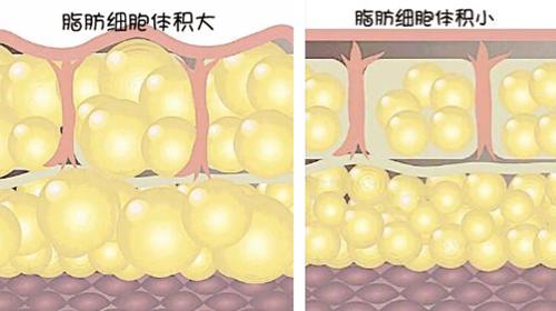 也能躺着塑身吸脂(吸脂脂肪手术细胞荆州)
