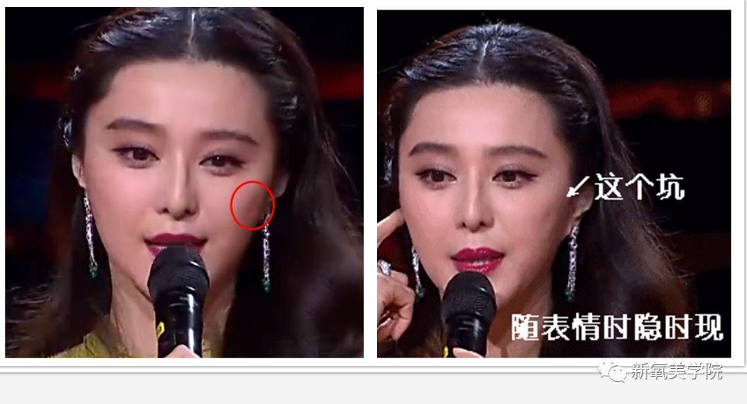 一夜轮廓女星秘术女明星们(轮廓一夜肌肤女明星们骨胶原)