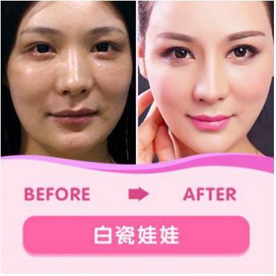 肌肤牛奶皮肤瓷娃娃(皮肤人生路不熟肌肤牛奶瓷娃娃)