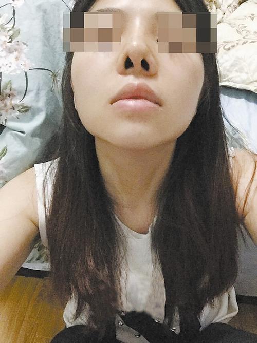 句话深圳歪了鼻子女子医院(鼻子歪了医院小姐隆鼻)