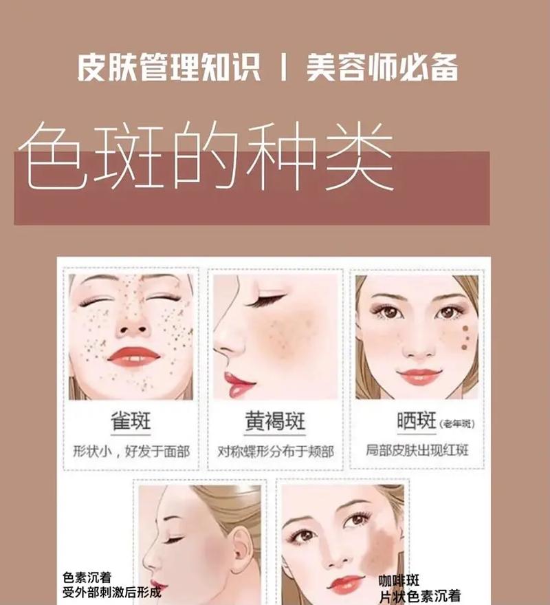 难解护肤品色斑轻松方法(色斑项目黑色素护肤品皮肤)