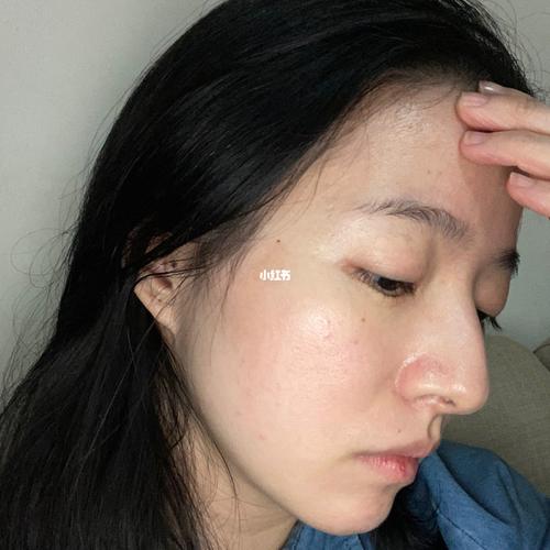 几次激光维持多久有哪些(激光皮肤几次效果维持多久)