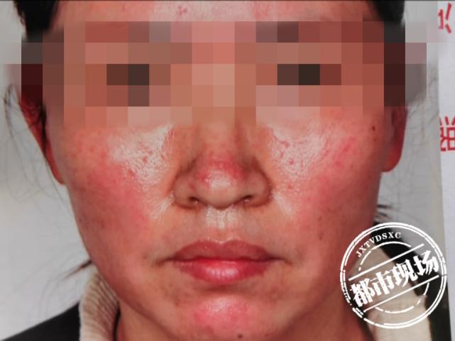 鹰潭十多皮肤女子克丽缇娜(鹰潭陈女士十多皮肤女子)