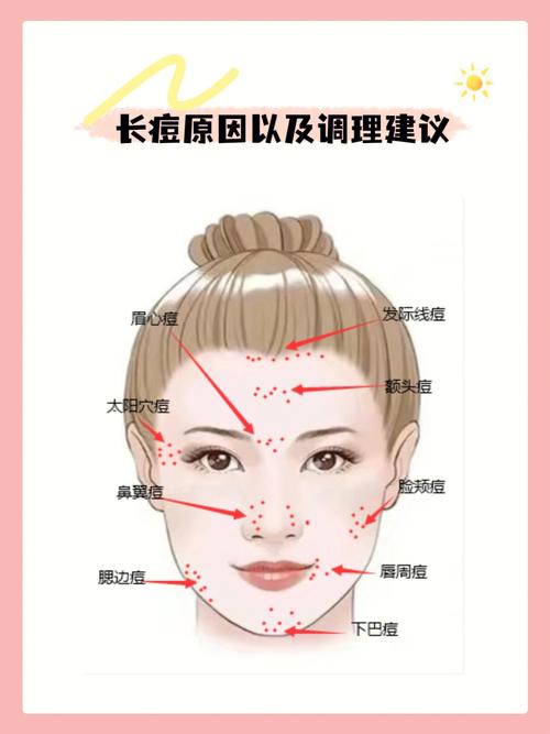 韩国皮肤科痘痘秘诀烦恼(韩国皮肤痘痘皮肤科痤疮)