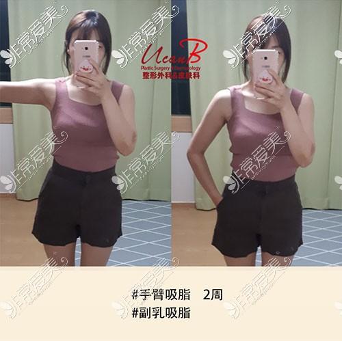 整形外科(整形外科真性的是腋窝患者)