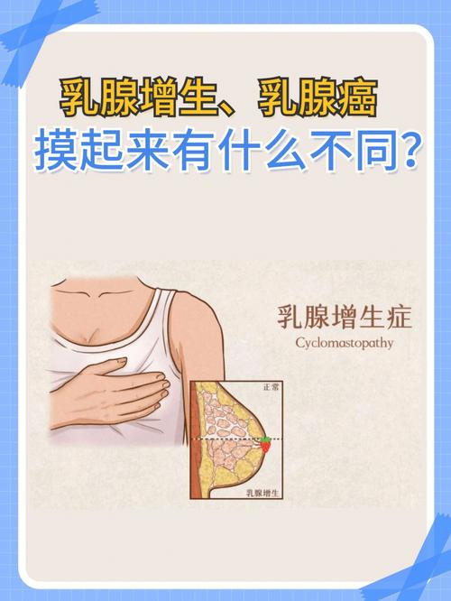 冬日六条乳腺增生女性(乳腺乳腺增生乳房女性六条)