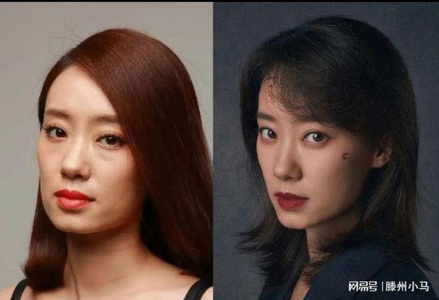 下颌手术指南学张小斐不垮脸(下颌手术软组织医生颧骨)