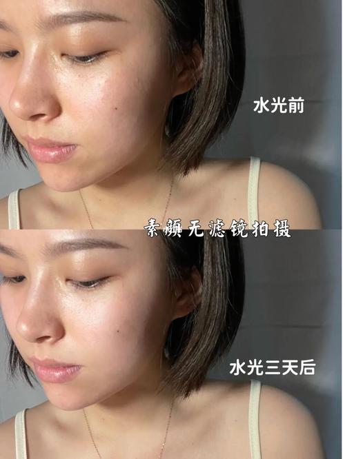 再选错了看完千万别肤质做啥医美(水光嫩肤光子再选错了)