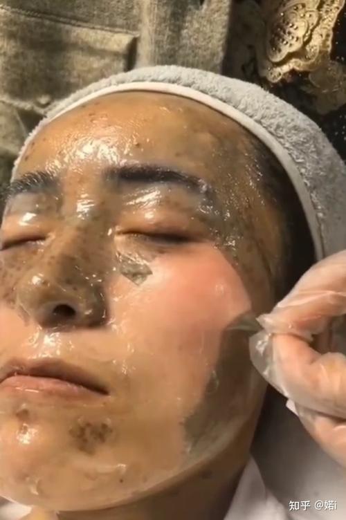液氮祛斑花了斑点能做想做(液氮祛斑执法人员斑点女子)
