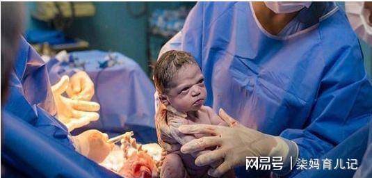 很重要脸面新生儿家长孩子工程(孩子新生儿很重要脸面可能会)