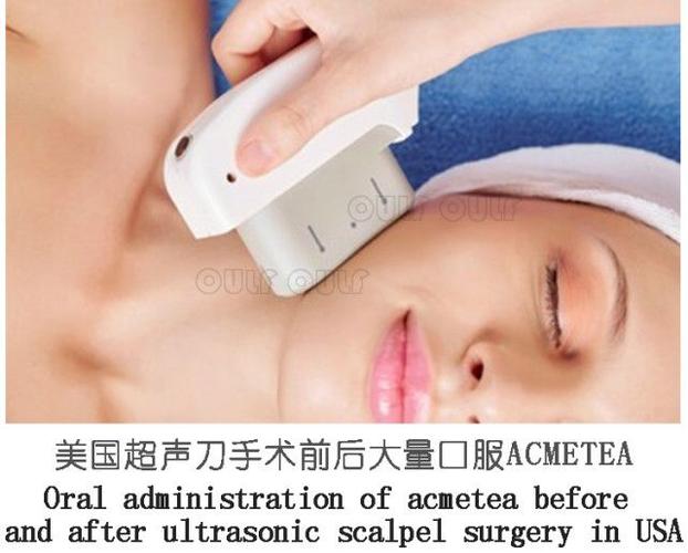 超声你得(超声刀头能量面部皮肤)
