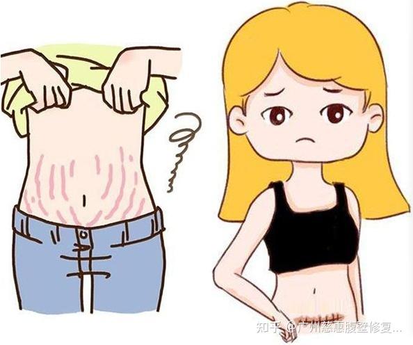 腹壁一台纤细腹部少女腰腹(腹壁腹部切口松弛一台)