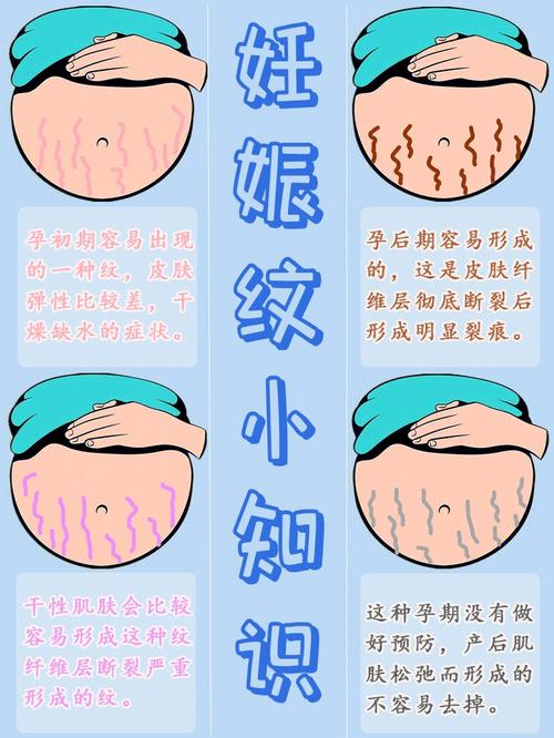 孕期你也可以孕妇学会了(孕期孕妇你也可以皮肤妊娠纹)