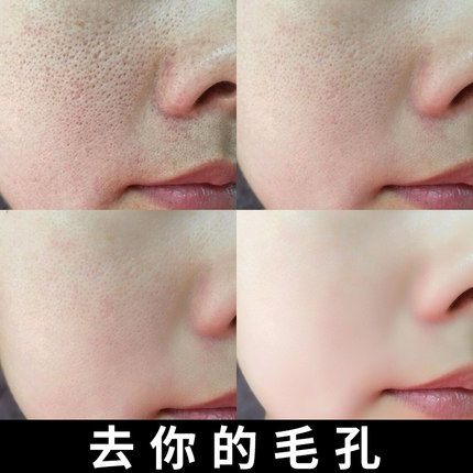 毛孔粗大美白补水肌肤细腻(毛孔肌肤美白效果补水)