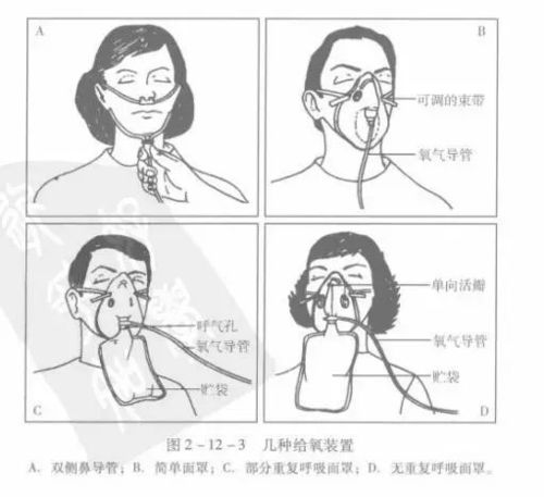 哪种有多种吸氧形式方式(吸氧面罩导管方式浓度)