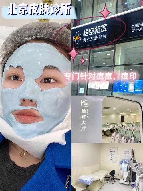 黑头毛孔秘密武器找到了痘印探店丨(毛孔黑头秘密武器找到了痘印)