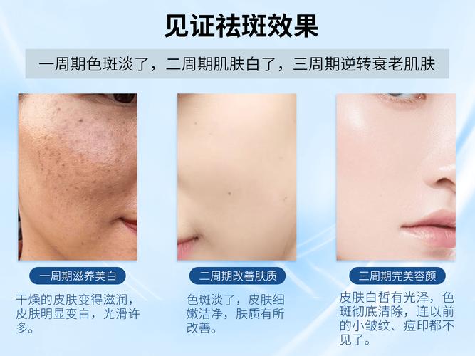 美白祛斑(维生素新华网美白胶丸祛斑)