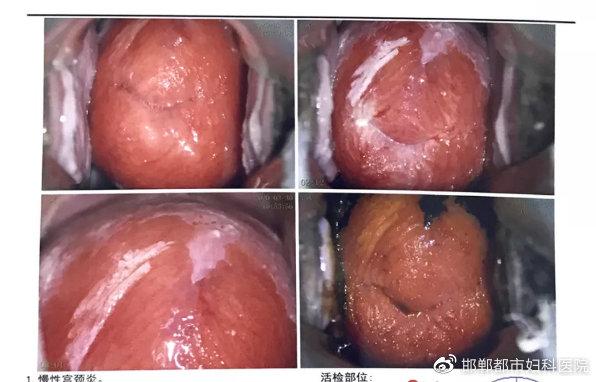 河北乳房附属医院平面镜下工程(乳房患者主任邯郸镜下)