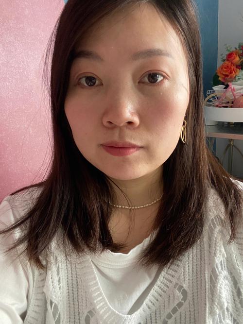 也要双眼皮人去祛斑激光老年(母亲女儿双眼皮手术妈妈)