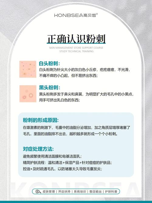 痘痘祛痘知识(痤疮痘痘祛痘毛囊青春期)