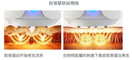 (射频电极皮肤胶原蛋白电场)
