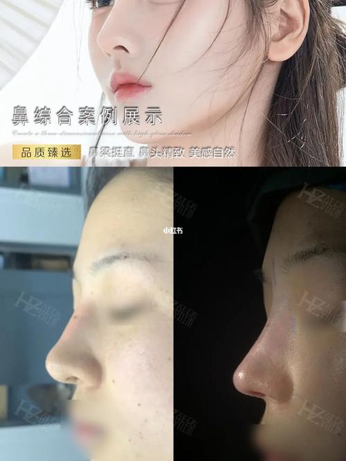 多做很好看院长鼻子透明(院长多做鼻子透明很好看)