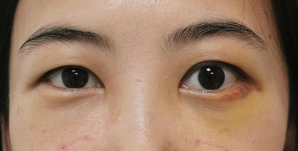 人来眼科眼部中心(眼科眼部人来眼袋中心)