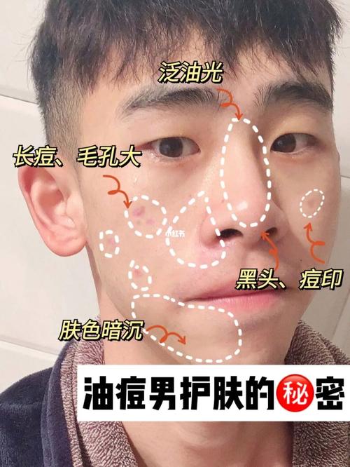 最好的几款控油祛痘男生方法(祛痘最好的几款控油男生)