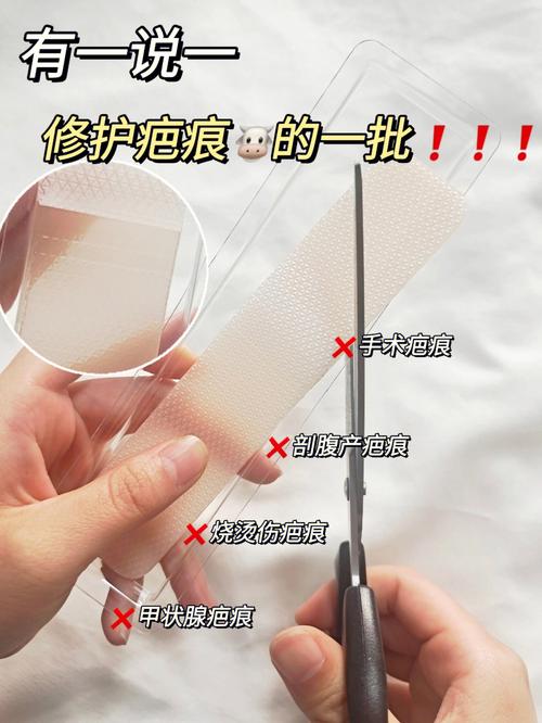 疤痕多维修护一站式多学科体系(瘢痕疤痕多维脉冲点阵)