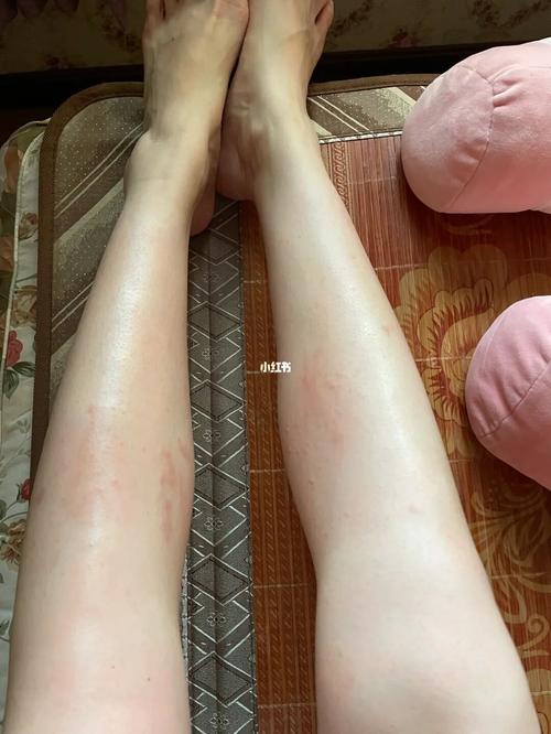 给你全身夏天(给你全身夏天毛发毛囊)