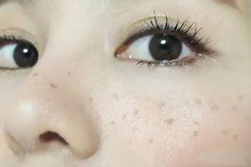 黑眼圈美白色斑功课变淡透明(黑眼圈美白色斑功课透明)