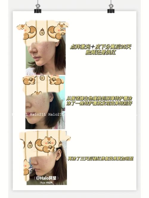 术后全靠激光活力皮肤薇诺娜(薇诺娜术后激光特护肌肤)