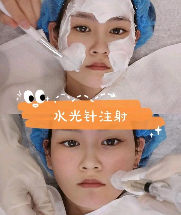 嫩肤光子蓝光祛斑美肤祛痘(嫩肤光子疗程项目蓝光)
